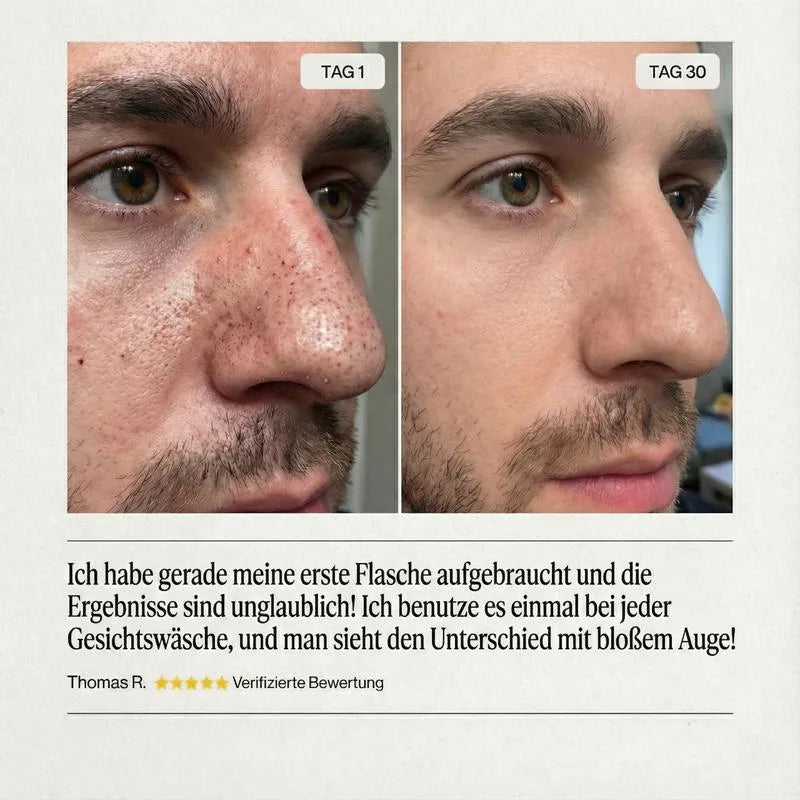 Basis Lab Peel Shot Duo — Dein 2-Schritt-Ritual für reine Haut